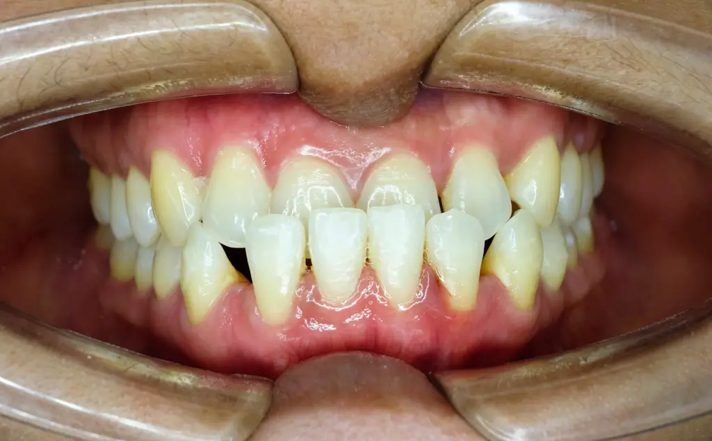 Ortopedia intercettiva